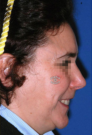 casi speciali casi speciali