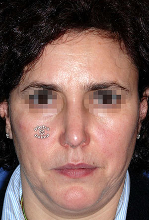 casi speciali casi speciali