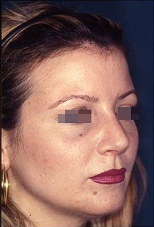 casi speciali casi speciali