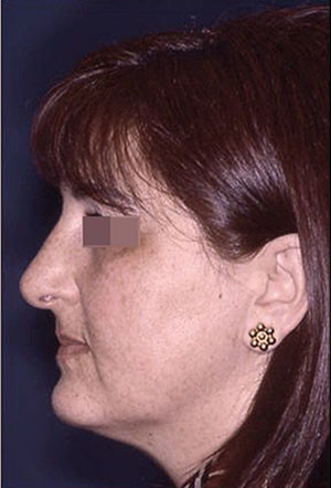 casi speciali casi speciali