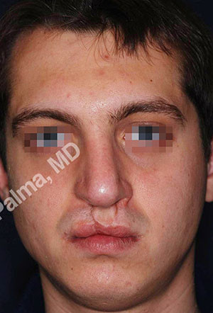 casi speciali casi speciali