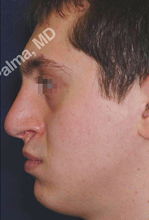 casi speciali casi speciali