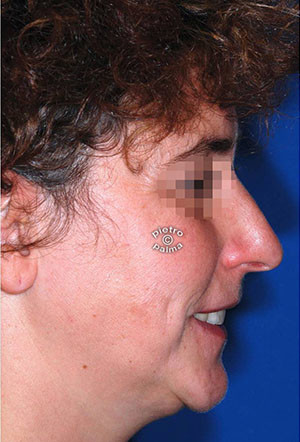 casi speciali casi speciali