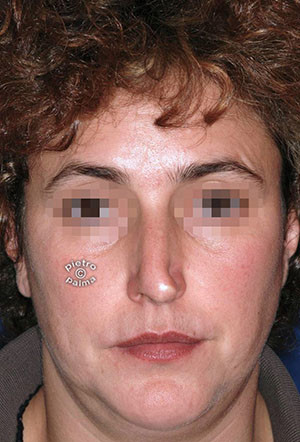 casi speciali casi speciali