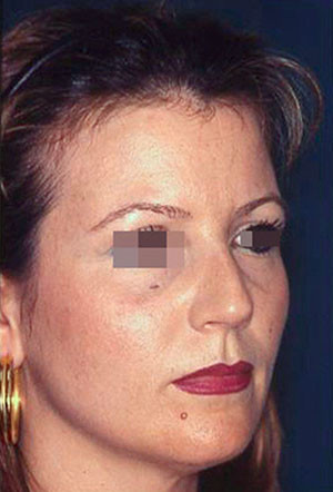 casi speciali casi speciali