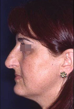 casi speciali casi speciali