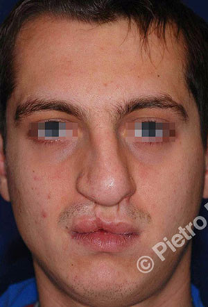 casi speciali casi speciali