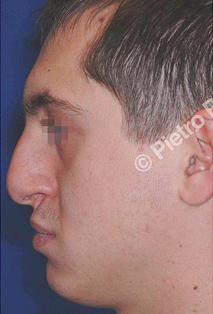 casi speciali casi speciali