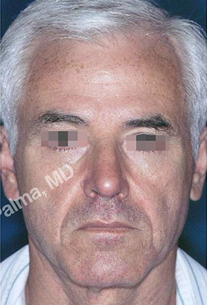 casi speciali casi speciali