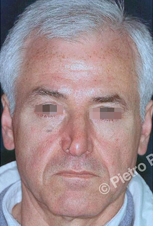 casi speciali casi speciali