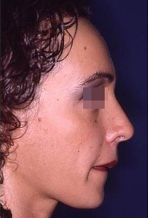 casi speciali casi speciali