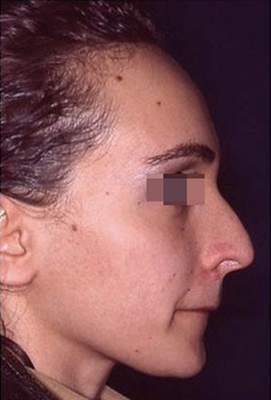 casi speciali casi speciali