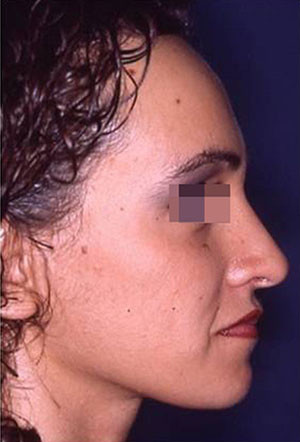 casi speciali casi speciali