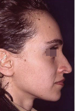 casi speciali casi speciali