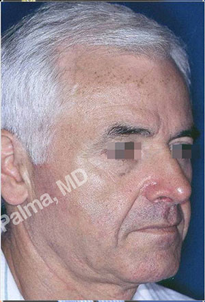 casi speciali casi speciali