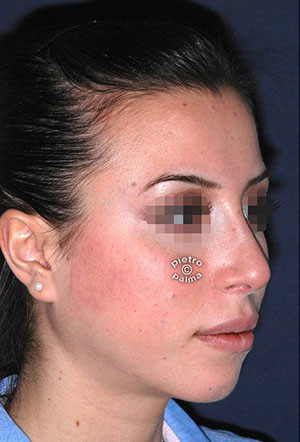 scultura punta del naso