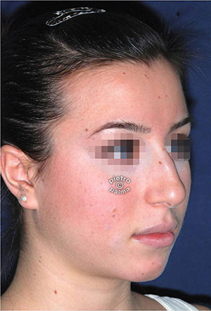 scultura punta del naso