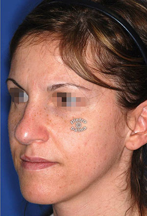 scultura punta del naso