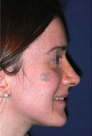 7 giorni dopo 7 giorni dopo