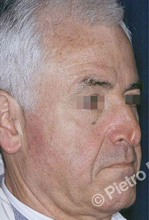 casi speciali casi speciali