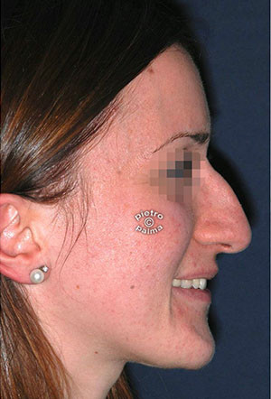 7 giorni dopo 7 giorni dopo