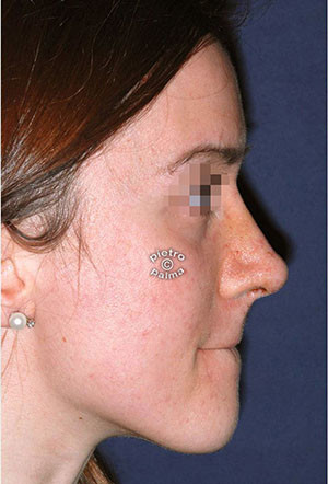 7 giorni dopo 7 giorni dopo