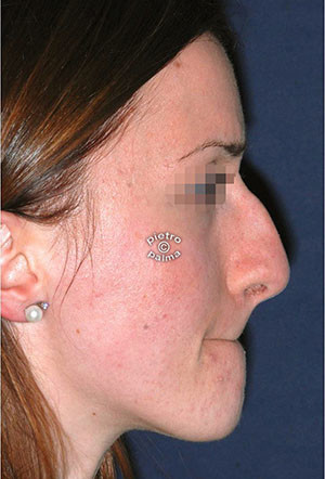 7 giorni dopo 7 giorni dopo