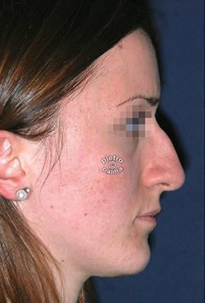 7 giorni dopo 7 giorni dopo